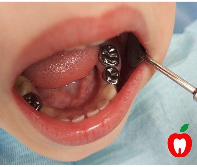 Детская ортодонтия и ортопедия